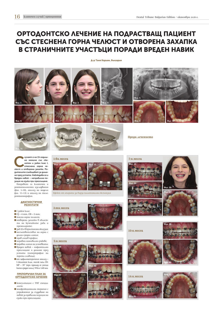 Страница 16 от Dental Tribune: диагностика и начални етапи на ортодонтското лечение